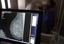 Planos de saúde terão de cobrir mamografia digital sem limite de idade